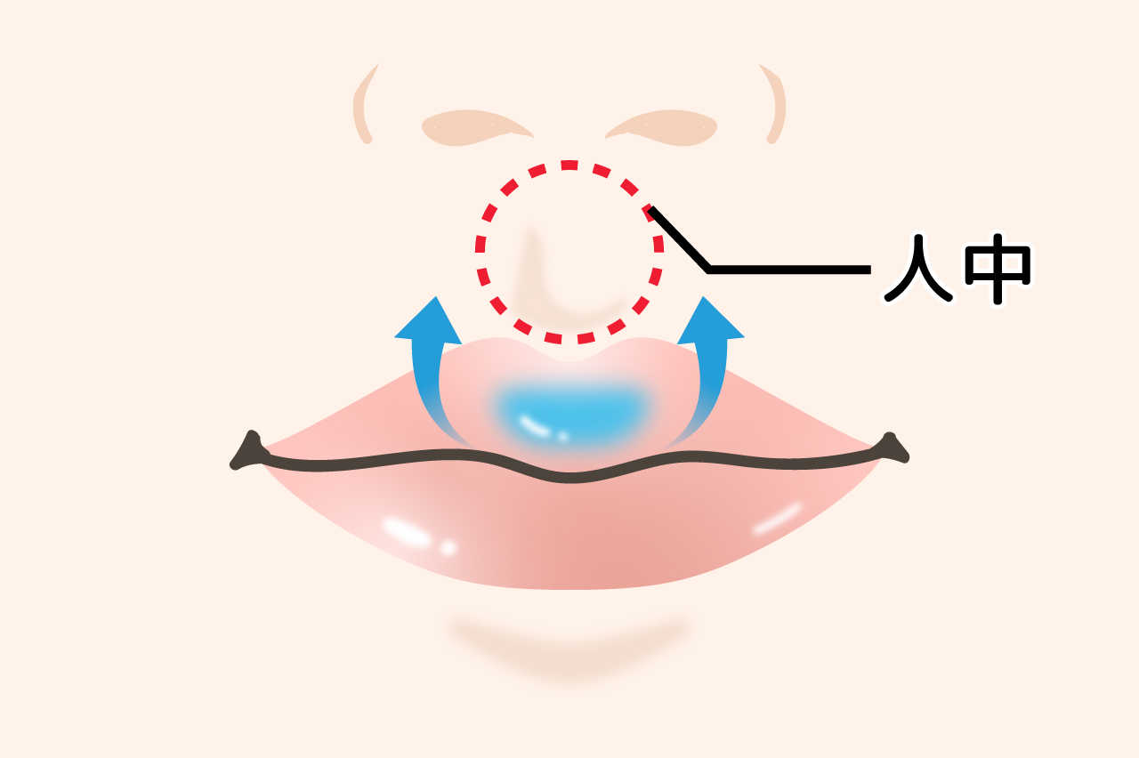 人中短縮（Cカール）でくっきりとしたくちびるに